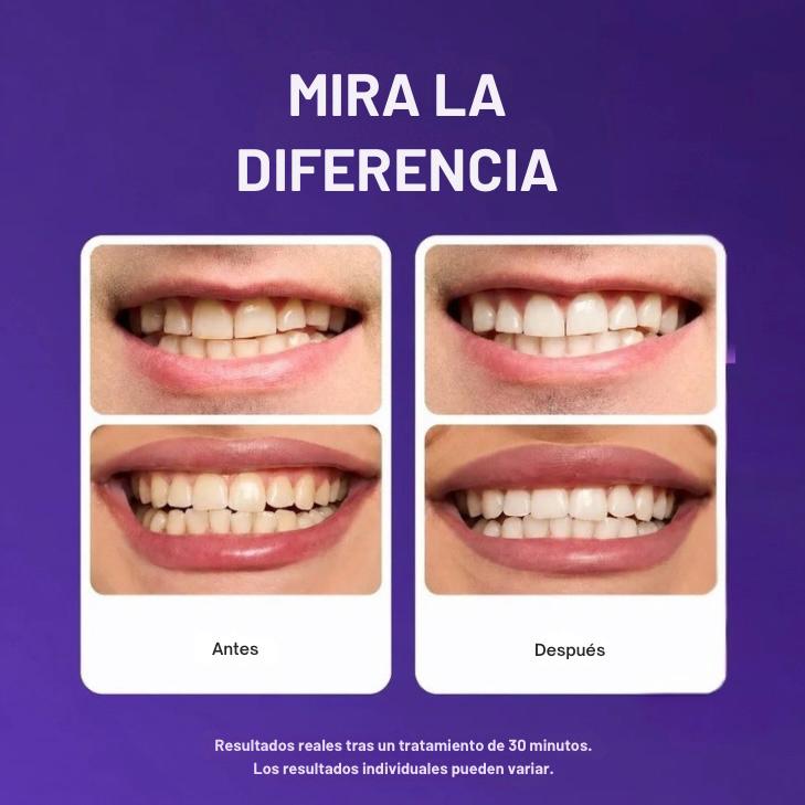 CEEL!KE - Tiras Moradas Blanqueadoras